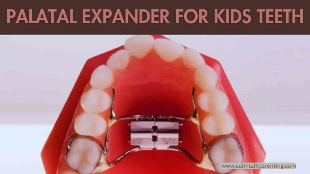 Palatal expander for kids teeth