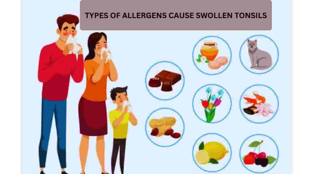 Types of allergens cause swollen tonsils