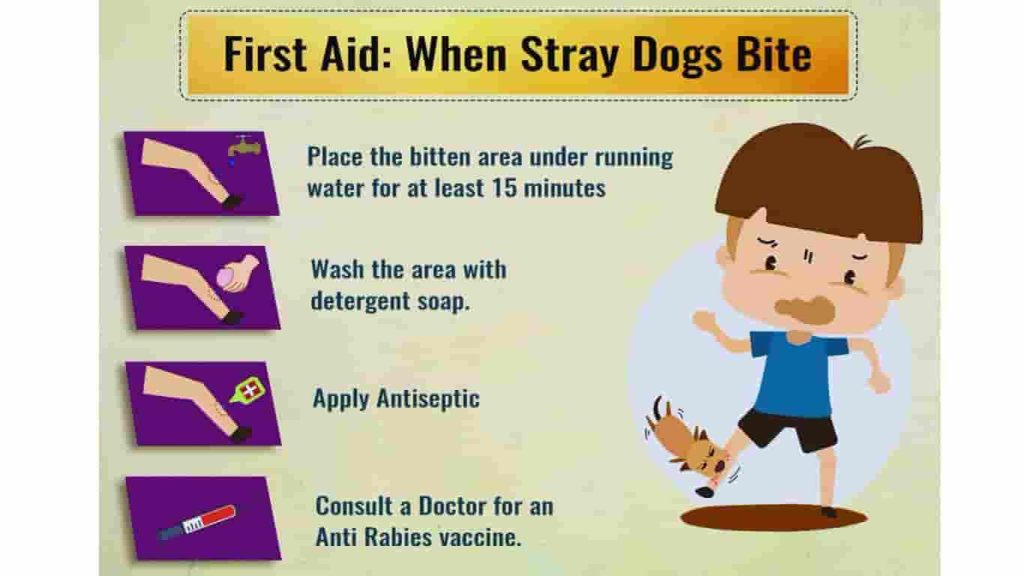 first aid when a dog bite to a kid